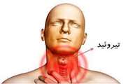 درباره کم کاری تیروئید چه می دانید