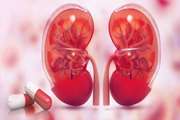 داروھای مصرفی در پیوند کلیه
